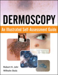 Dermoscopy: an illustrated guide