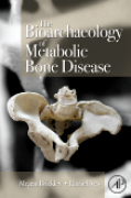 The bioarchaeology of metabolic bone disease