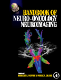 Handbook of neuro-oncology neuroimaging
