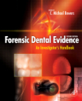 Forensic dental evidence: an investigator's handbook
