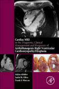 Cardiac MRI in Diagnosis, Clinical Management and Prognosis of Arrythmogenic Right Ventricular Dysplasia/Cardiomyopathy