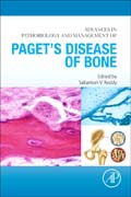 Advances in Pathobiology and Management of Pagets Disease of Bone