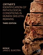 Identification of Pathological Conditions in Human Skeletal Remains