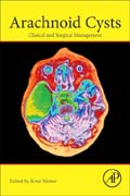 Arachnoid Cysts: Clinical and Surgical Management