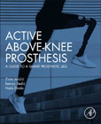 Active Above-Knee Prosthesis: A Guide to a Smart Prosthetic Leg