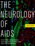 The neurology of aids
