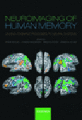 Neuroimaging in human memory: linking cognitive processes to neural systems