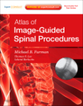 Atlas of image-guided spinal procedures: expert consult - online and print