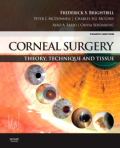 Corneal surgery