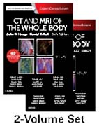 CT and MRI of the Whole Body, 2-Volume Set