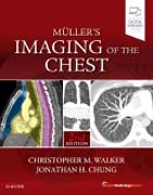 Mullers Imaging of the Chest: Expert Radiology Series