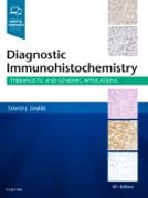 Diagnostic Immunohistochemistry: Theranostic and Genomic Applications
