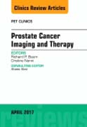 Prostate Cancer Imaging and Therapy, An Issue of PET Clinics