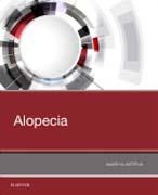 Alopecia Manual with Trichoscopic and Pathologic Correlations