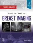 Breast Imaging: The Core Requisites