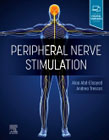 Peripheral Nerve Stimulation: A Comprehensive Guide