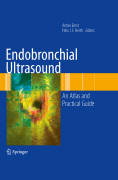 Endobronchial ultrasound: an atlas and practical guide