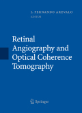 Retinal angiography and optical coherence tomography