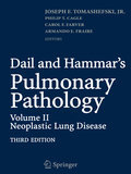 Dail and Hammar's pulmonary pathology v. 2 Neoplastic lung disease