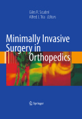Minimally invasive surgery in orthopedics