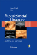 Musculoskeletal ultrasound: anatomy and technique