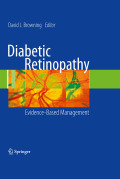 Diabetic retinopathy: evidence-based management