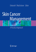 Skin cancer management: a practical approach