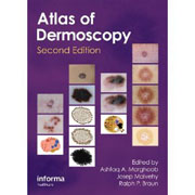 Atlas of dermoscopy