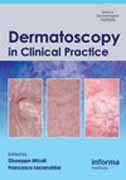 Dermatoscopy in clinical practice: beyond pigmented lesions