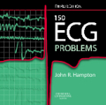 150 ECG problems