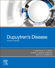 Dupuytrens Disease: A Scientific Review
