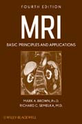 MRI: basic principles and applications