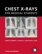Chest X-rays for medical students
