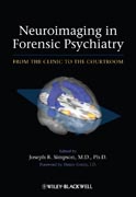 Neuroimaging in forensic psychiatry: from clinic to the courtroom