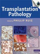 Transplantation pathology