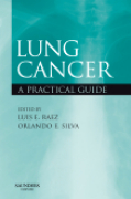 Lung cancer: a practical guide