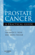 Prostate cancer: a practical guide