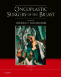 Oncoplastic surgery of the breast