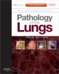 Pathology of the lungs: expert consult - online and print