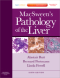 Macsween's pathology of the liver: expert consult: online and print