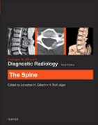 Grainger & Allisons Diagnostic Radiology: The Spine