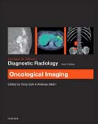 Grainger & Allisons Diagnostic Radiology: Oncological Imaging