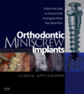 Orthodontic miniscrew implants: clinical applications