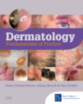 Dermatology: fundamentals of practice