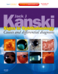 Signs in ophthalmology. (Expert consult : online and print): causes and differential diagnosis