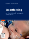 Breastfeeding: an atlas of diagnosis and treatment