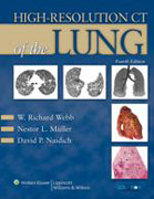High-resolution CT of the lung