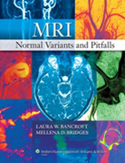 MRI normal variants and pitfalls