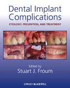 Dental implant complications: etiology, prevention, and treatment