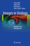 Images in urology: diagnosis and management